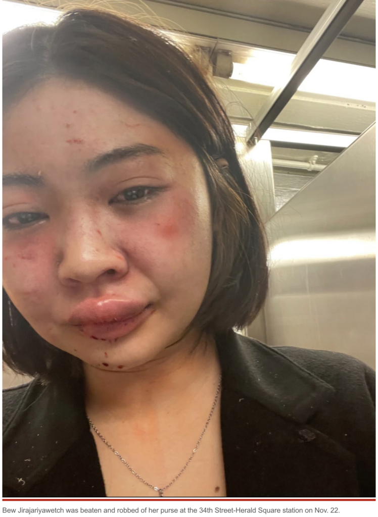 Bew Jirajariyawetch mugged and beaten in NYC subway